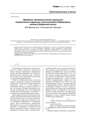 Модификация головки блока цилиндров: способ увеличить мощность двигателя |  Автомобильный маньяк | Дзен