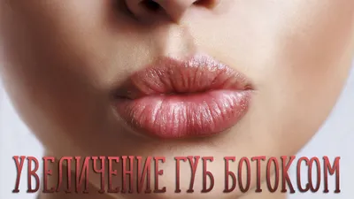 Увеличение губ - Фото ДО и ПОСЛЕ | Vidnova