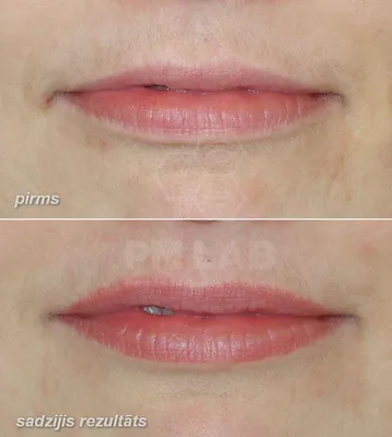 Больно ли делать татуаж губ: отзывы, фото до и после