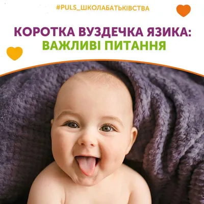 Короткая ли уздечка у новорожденного? — 5 ответов | форум Babyblog