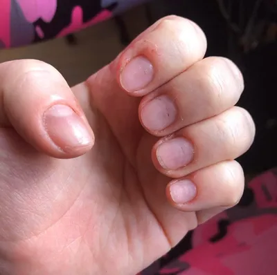 МАНИКЮР БЕЗ КУПЮР FAIL NAIL Неудачный и ужасный маникюр. Непризнанные  шедевры красоты. #ногти #гельлак #юмор #фейл #маникюр… | Crazy nail art,  Manicure, Fail nails