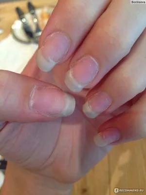 Unsuccessful and terrible manicure. Unrecognized masterpieces of beauty.  Dear ladies, do not do it! МАНИКЮР БЕЗ КУПЮР - FAIL NAIL Н… | Fail nails,  Manicure, Nails