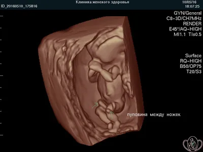 Пол ребенка - Вопросы о беременности - BabyPlan