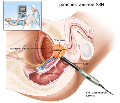 Как и зачем делают УЗИ малого таза? - MEDСЕМЬЯ