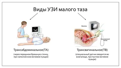 УЗИ органов малого таза в Уфе по доступной цене (матки и придатков) | Alimma