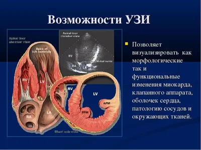 УЗИ сердца | УЗИ органов и систем