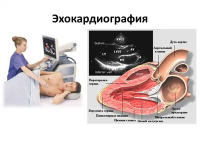 УЗИ сердца у животных: кошек, собак и других животных в России