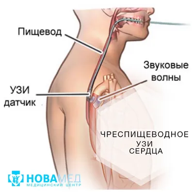 Детское УЗИ УЗИ сердца в Феодосии | Медицинский центр «ЗДОРОВЬЕ», Крым