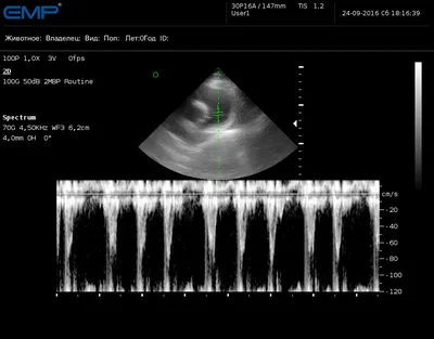 Чреспищеводное УЗИ сердца в «НОВАМЕД»
