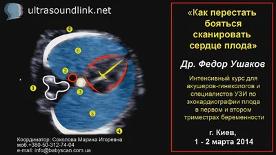 УЗИ сердца ребенку — быстрый и безвредный метод диагностики | 1ДМЦ