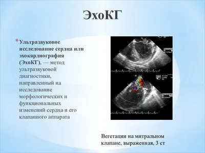 Показания к проведению УЗИ сердца | Anamed.md