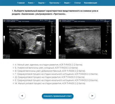 Использование сонографии в тиреодологии