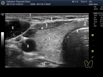 Узи щитовидной железы - сделать в СПб, цены на узи щитовидки