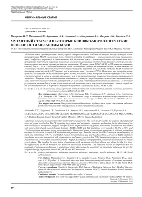 Меланома кожи: причины, симптомы и признаки, стадии, методы лечения и  прогноз