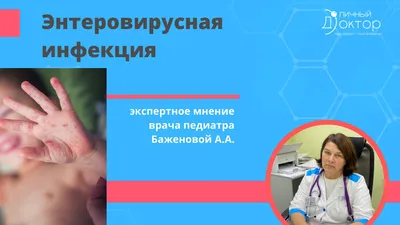 Вирус Коксаки - причины появления, симптомы заболевания, диагностика и  способы лечения