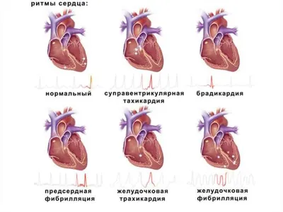 Фан-арт: «В ритме сердца» G » Спаффи-world