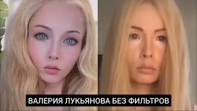 Валерия Лукьянова до и после пластики, фото, как выглядит сейчас (3 видео)