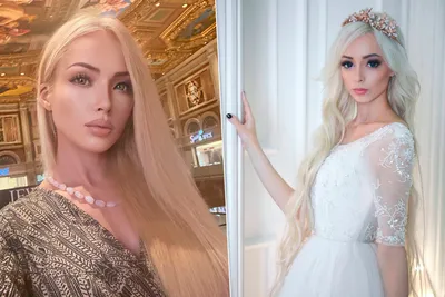 Валерия Лукьянова до и после пластики, фото «живой Барби» - 300 экспертов.РУ