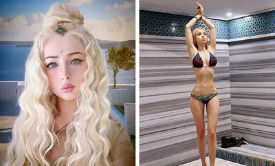 Валерия Лукьянова - одесская кукла Барби. Фото до и после операций