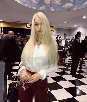 Валерия Лукьянова - одесская кукла Барби. Фото до и после операций