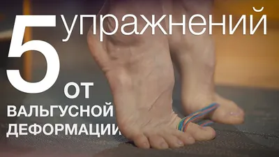 Вальгус (Valgus) | Ортофит