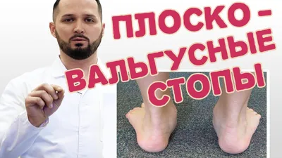 Вальгусная деформация стопы: причины, симптомы и лечение всех видов  заболеваний в ФНКЦ ФМБА в Москве