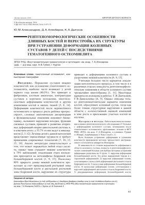 Вальгусная деформация стопы | Лечение вальгуса стопы у детей и взрослых ᐉ  Ladisten