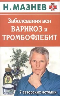 ЧЕМ ТРОМБОФЛЕБИТ ОТЛИЧАЕТСЯ ОТ ВАРИКОЗА | Медцентр Южный. Сосудистая  клиника. Москва. | Дзен