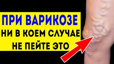 Варикоцеле: причины, симптомы, способы лечения - AXEL Clinic