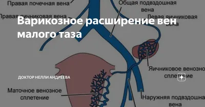 Варикоз при беременности ⋆ varicose.kiev.ua