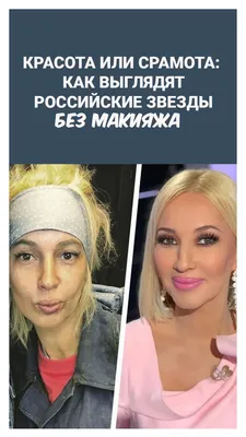 Екатерина Варнава — фото до пластики и после: 4 операции, навсегда  изменившие внешность звезды | WOMAN