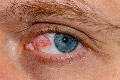Венозный синус глаза: анатомия, функции и расстройства | Moseyes