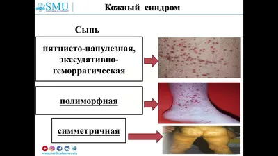 Васкулит кожи собак и кошек - Ветеринарная клиника доктора Шустовой |  Ветеринар Балаково