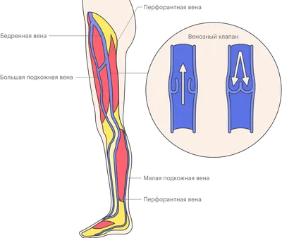 Варикозное расширение вен | Симптомы | Диагностика | Лечение - Lik.ua