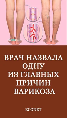 Вопросы флебологу: почему появляется варикоз и как его предотвратить,  причины тромбоза