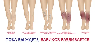 Лечение гемангиомы (ангиомы) в Киеве — Derma.ua