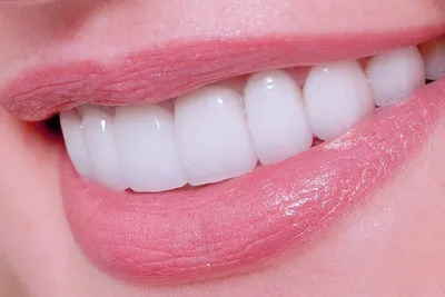 Съемные протезы верхних зубов - цена от 15000 ₽ в Санкт-Петербурге |  клиника Медикор