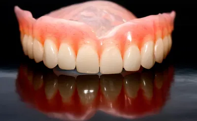 Съёмные БЕЗ нёба существуют? #стоматология #протезированиезубов - YouTube