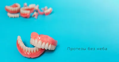 Варианты замены полного отсутствия зубов имплантами и протезированием –  Немецкий имплантологический центр, Москва