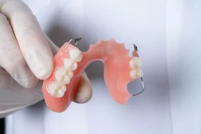 Съемный зубной протез на верхнюю челюсть купить в Denta-Labor | Полные съемные  протезы при полном отсутствии зубов на верхней челюсти цена