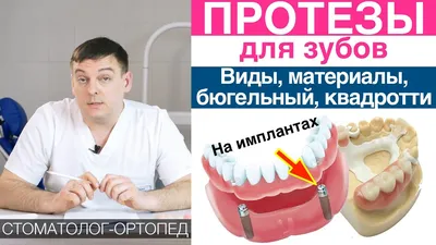 Установить бюгельный протез зубов в Хабаровске | цена от 40 000 руб.
