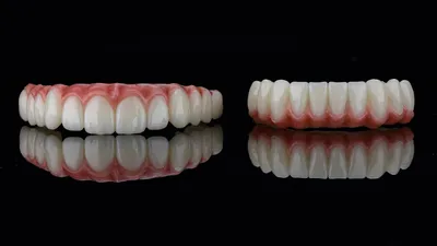 Зубные протезы - виды зубных протезов, бюгельный протез, квадротти,  акрифри, протезы на имплантах - YouTube