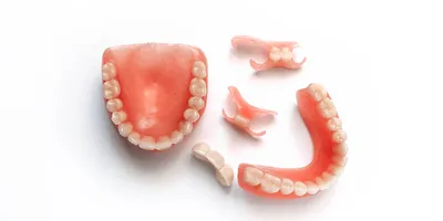 Ацеталовые зубные протезы - показания, противопоказания, плюсы, минусы,  изготовление, установка, уход