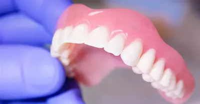 Съемное протезирование зубов в Новосибирске, цены | Клиника «Стоматология  32»