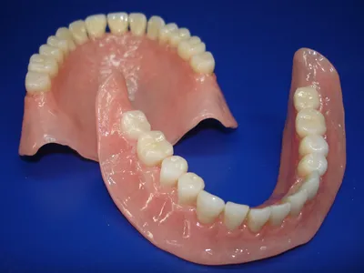 Съемные Зубные Протезы На Челюсти 3 Вида Люмидент