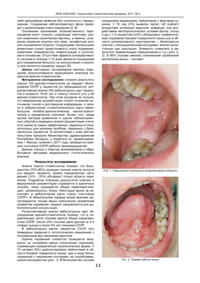 Дентал Юг, ноябрь 2009, 11 (71) by Dental Magazine - Issuu