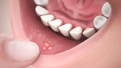 Инфекционные заболевания с проявлениями в полости рта. Принципы диаг