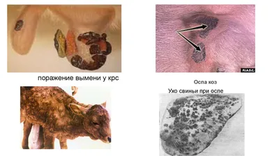 Доктор Комаровский - Натуральная оспа — единственная инфекционная болезнь,  полностью истребленная человечеством. В Средние века в Европе от нее  умирало по полтора миллиона человек в год. 14 мая 1796 года английский врач