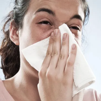 Аллергия на гель-лак! Что делать? | imkosmetik журнал