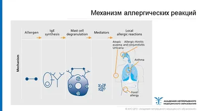 Аллергия на казеин: симптомы на doc.ua